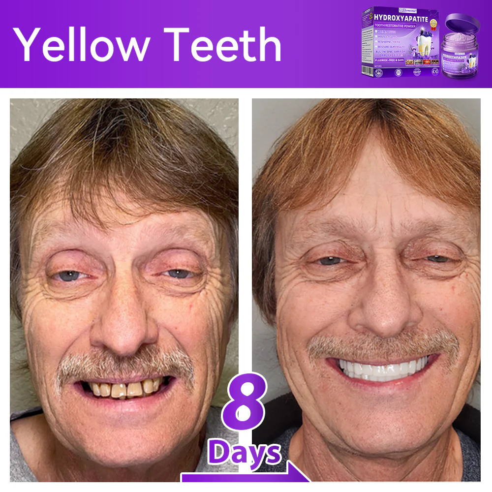 🎉 New Year Special: 80% OFF 🏆 Dormorna® Hydroxyapatite Tooth Restorative Powder 🦷 - Image 3