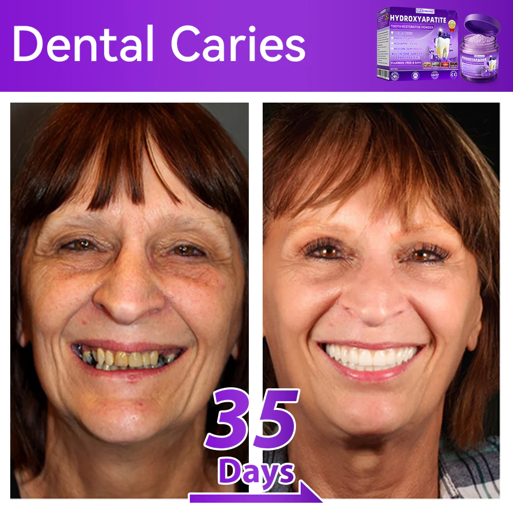 🎉 New Year Special: 80% OFF 🏆 Dormorna® Hydroxyapatite Tooth Restorative Powder 🦷 - Image 4