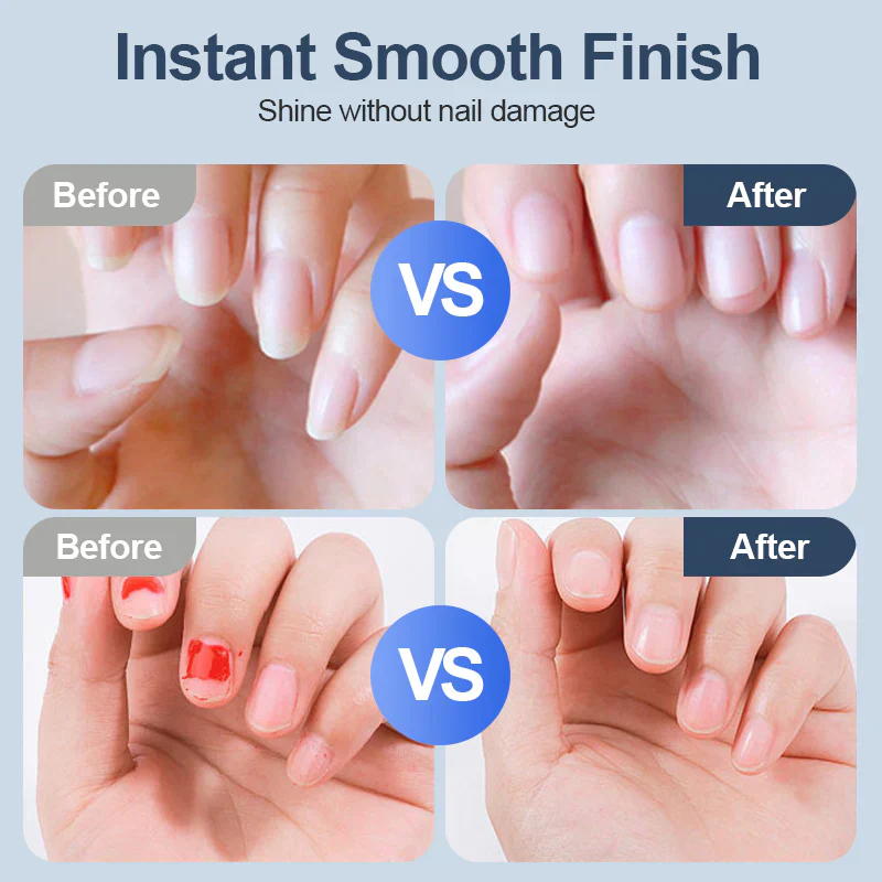 👶🔧Universal Automatic Fingernail Grinder - 6 Speed Settings with 5 Attachments for Safe & Gentle Nail Care 💅✨ - Image 2